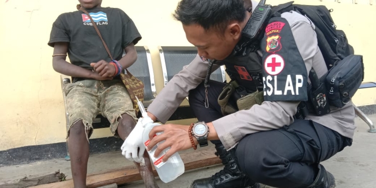 Keladi Sagu Bantu Anak-anak di Puncak Obati Penyakit Kulit