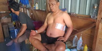 Kontak Senjata di Baya Biru, Satu Polisi dan Satu Warga Sipil Alami Luka Tembak