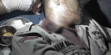 Seorang Polisi Dilarikan ke Rumah Sakit Akibat Dibacok